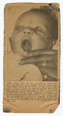 Sam Ringgold Jr. born with a tooth